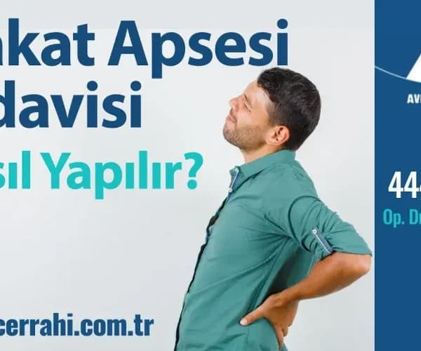 Anal Apse Tedavisi Fiyatları Hangi Kriterlere Göre Belirlenmektedir?