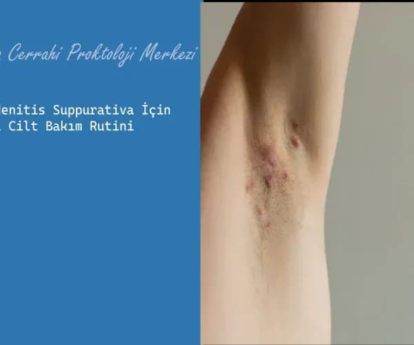 Hidradenitis Suppurativa İçin En İyi Cilt Bakım Rutini