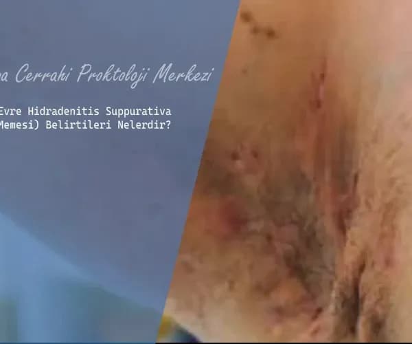 Üçüncü Evre Köpek Memesi Belirtileri ve Tedavi Seçenekleri
