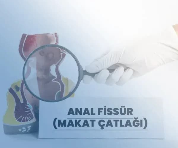 Anal Fissür Nedir?