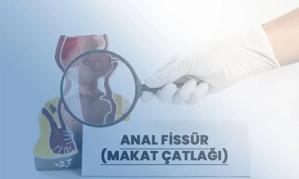 Anal Fissür (Makat Çatlağı)