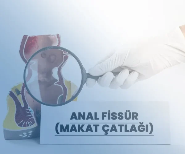 Anal Fissür (Makat Çatlağı)
