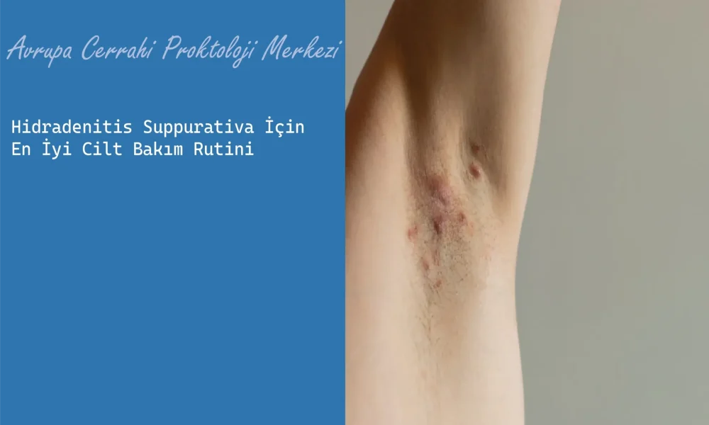 Hidradenitis Suppurativa İçin En İyi Cilt Bakım Rutini