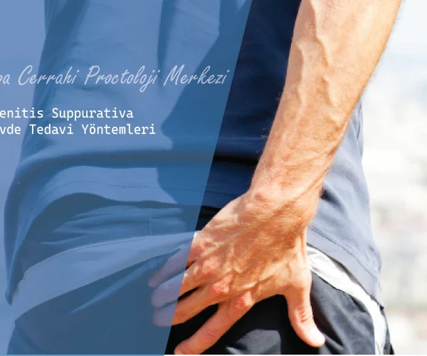 Hidradenitis Suppurativa İçin Evde Tedavi Yöntemleri