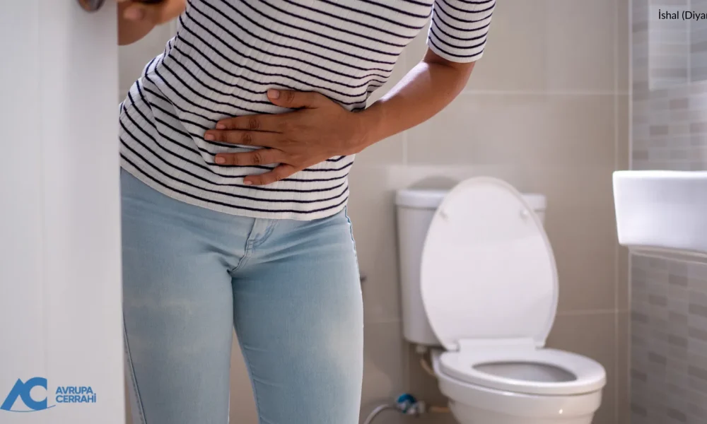 İshal (Diyare) Nedir? Çeşitleri Nelerdir? Ne İyi Gelir?