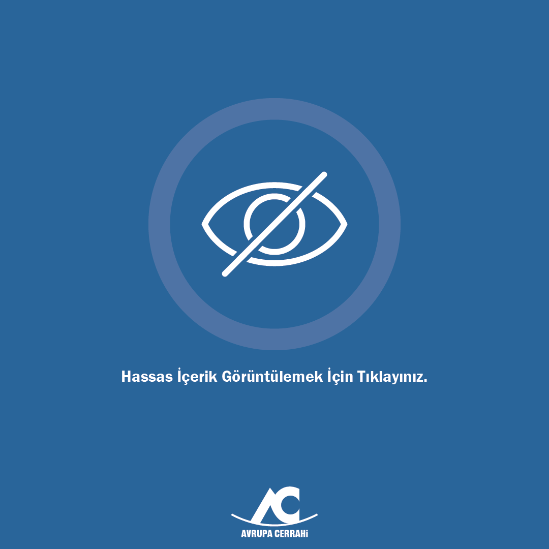hidra-000002