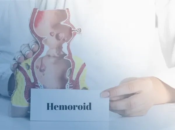 Hemoroid yani basur birçok kişi tarafından yaşanan bir sağlık problemidir.