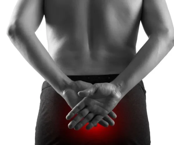 Rektal problasus Nedir?