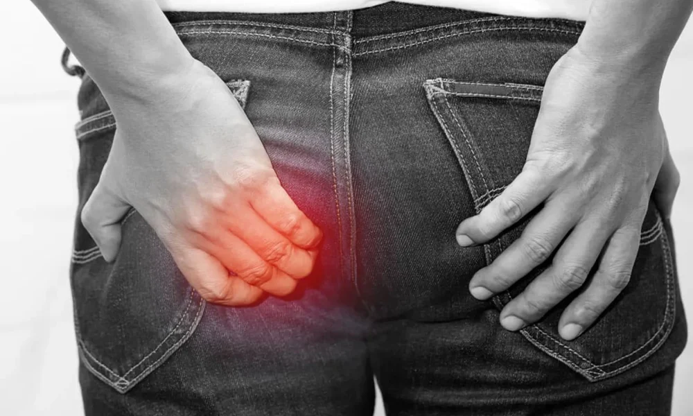Transsfinkterik Anal Fistül Nedir? Tedavisi Nasıl Yapılır?