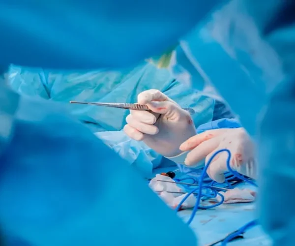 Anal fistül tedavisi avrupa cerrahi kliniği hızlı ve acısız tedavi yöntemleri