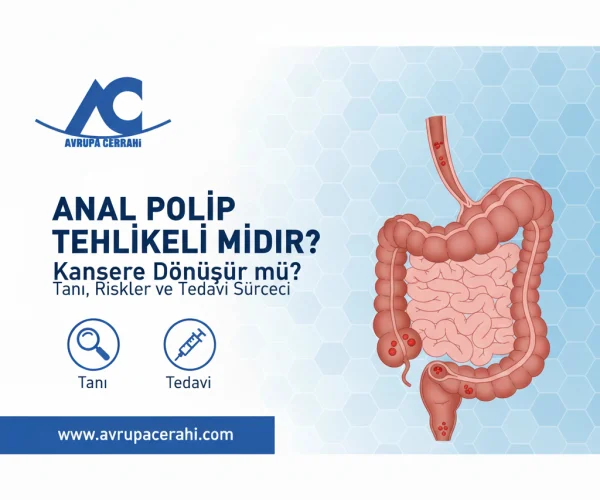 Anal Polip Tehlikeli midir