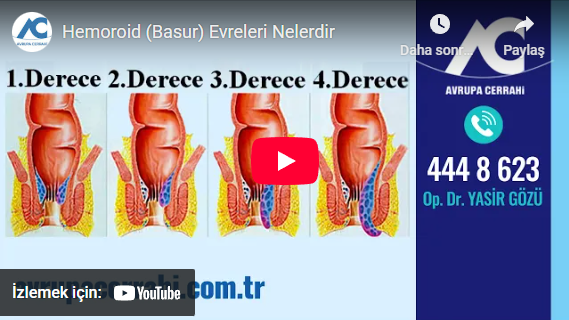 hemoroid evreleri