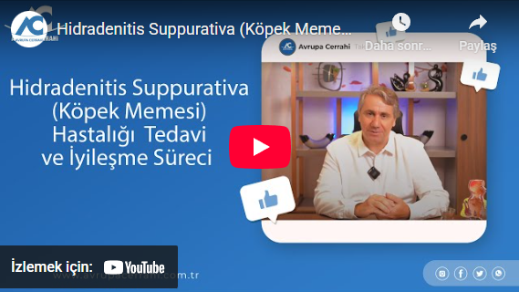 köpek memesi
